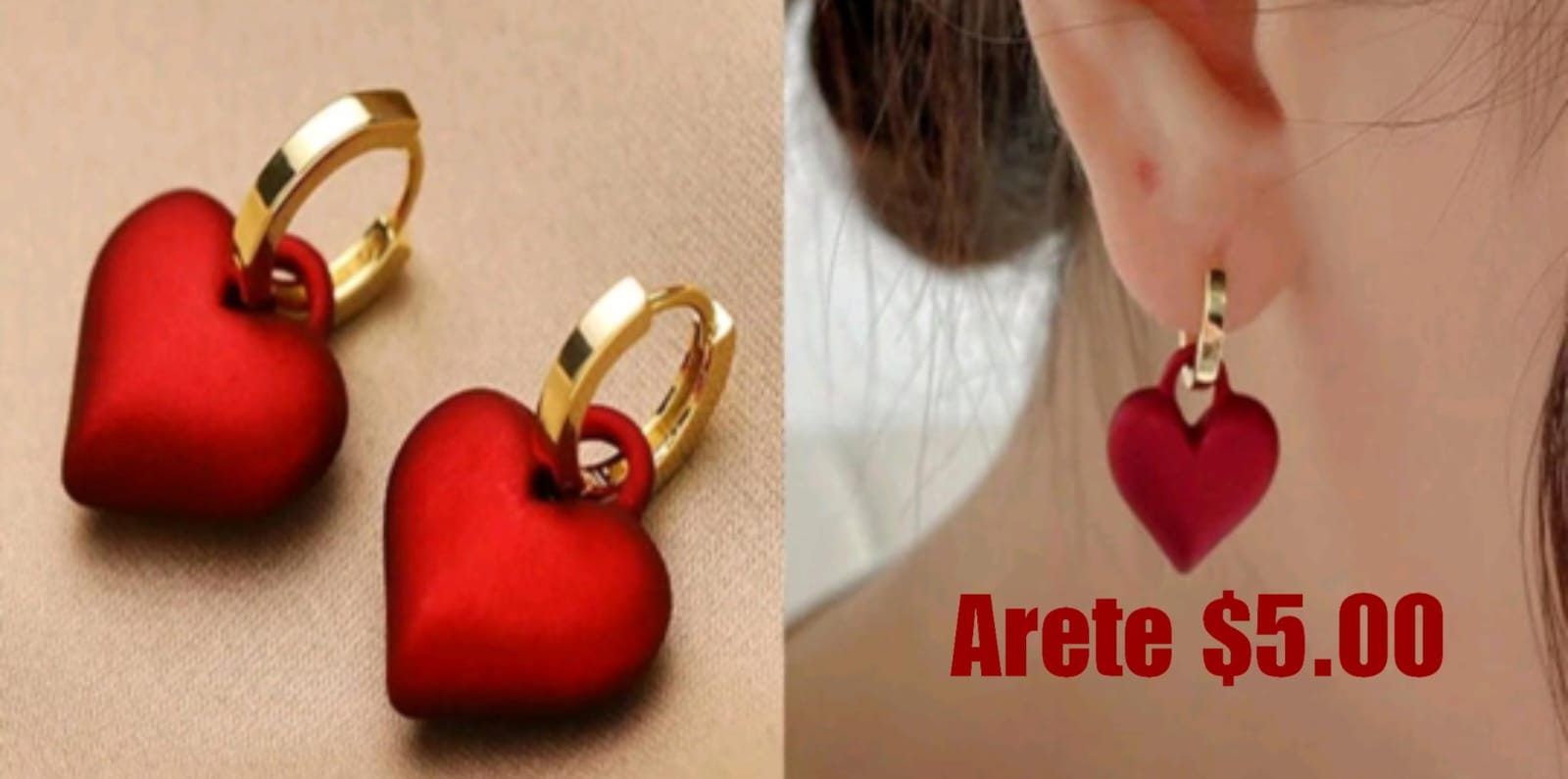 Aretes
